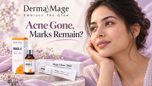 Acne Is Gone, So Why Are the Dark Marks Still There?